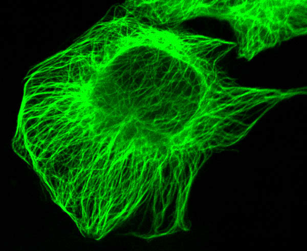 img2_HeLa_cells_transfected_with_EGFP-tubulin_Live_cell_imaging.jpg